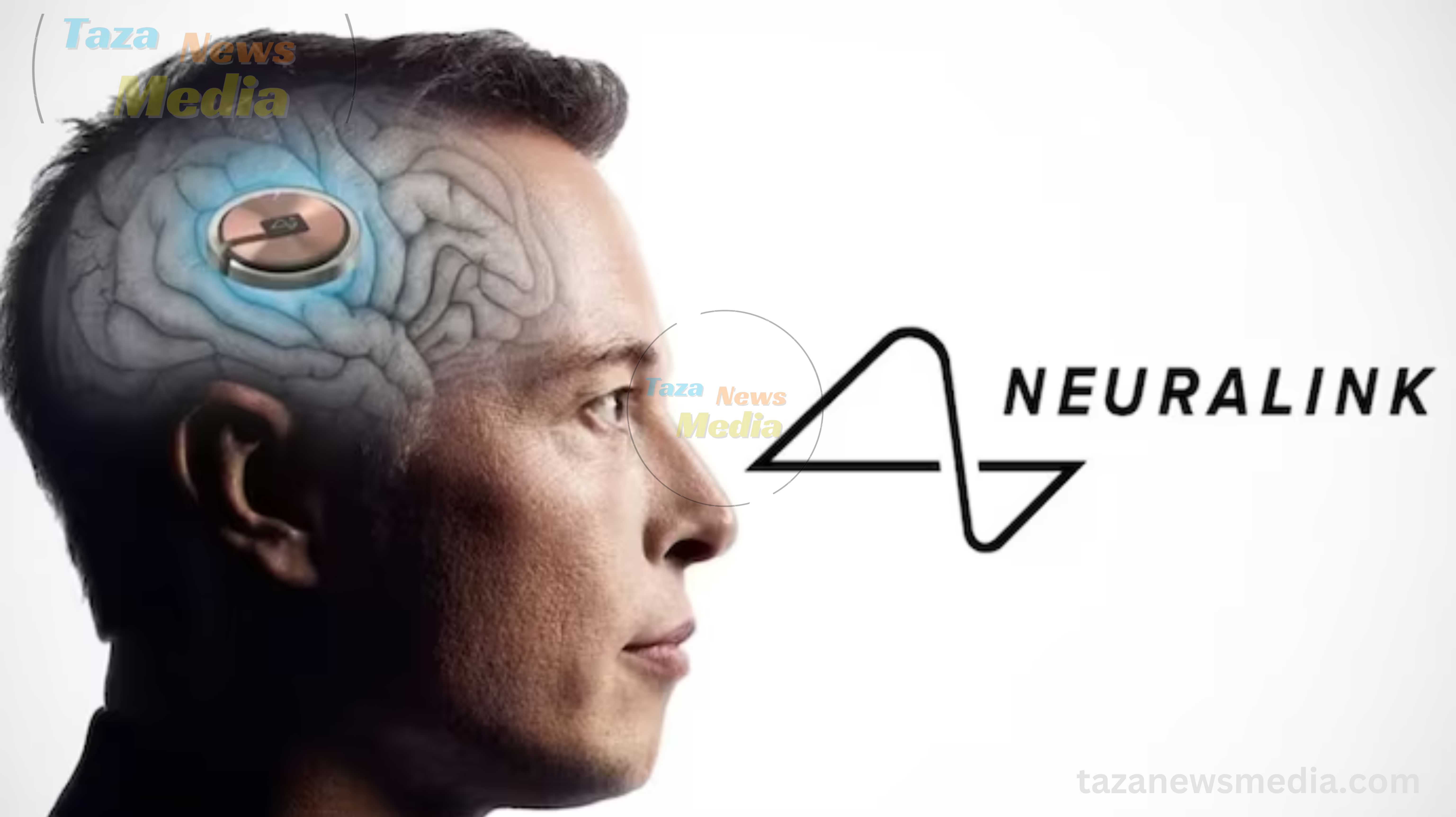 Elon Musk's proposed brain chip fails? An update on the first individual implanted by Neuralink